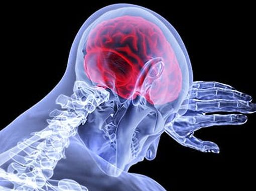 Lo que debes saber sobre las lesiones cerebrales traumáticas