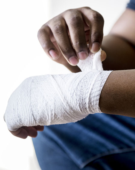 Burn Injury