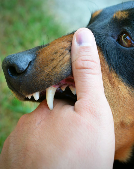 Dog Bite